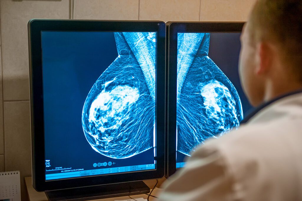 A doctor examining a mammogram.