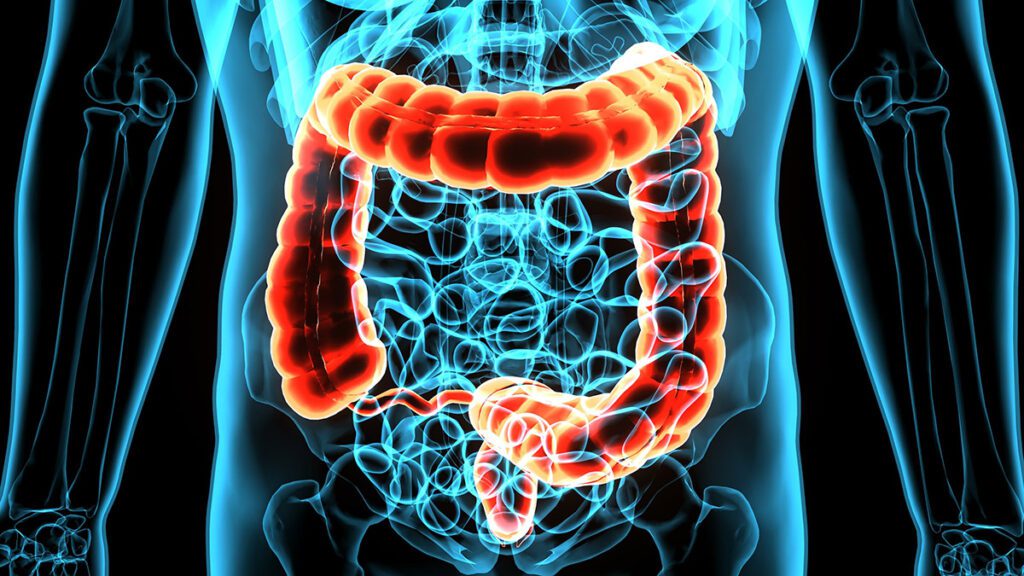 A 3D Rendering of the colon.