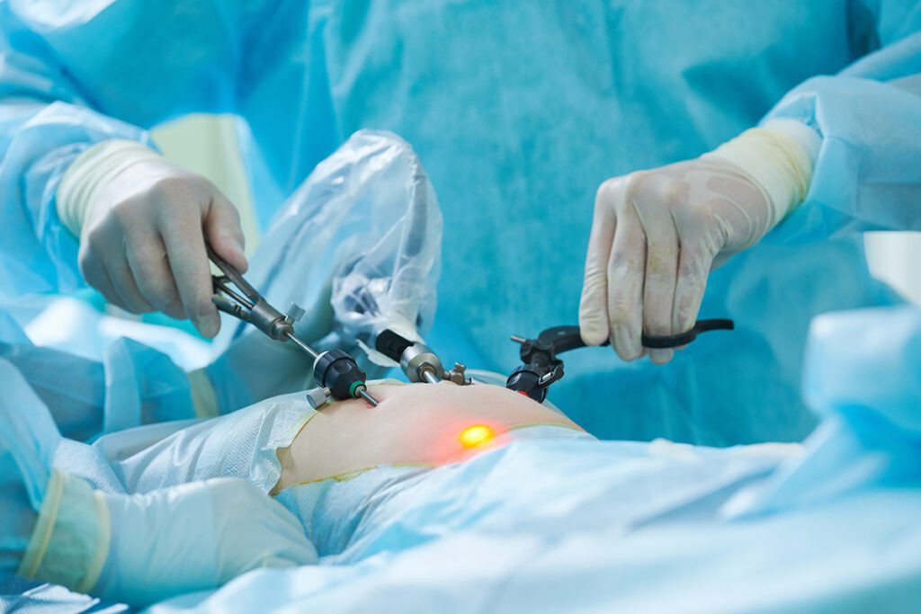 Nurses performing a laparoscopic procedure.